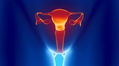 Ілюстрація трихомоніазу